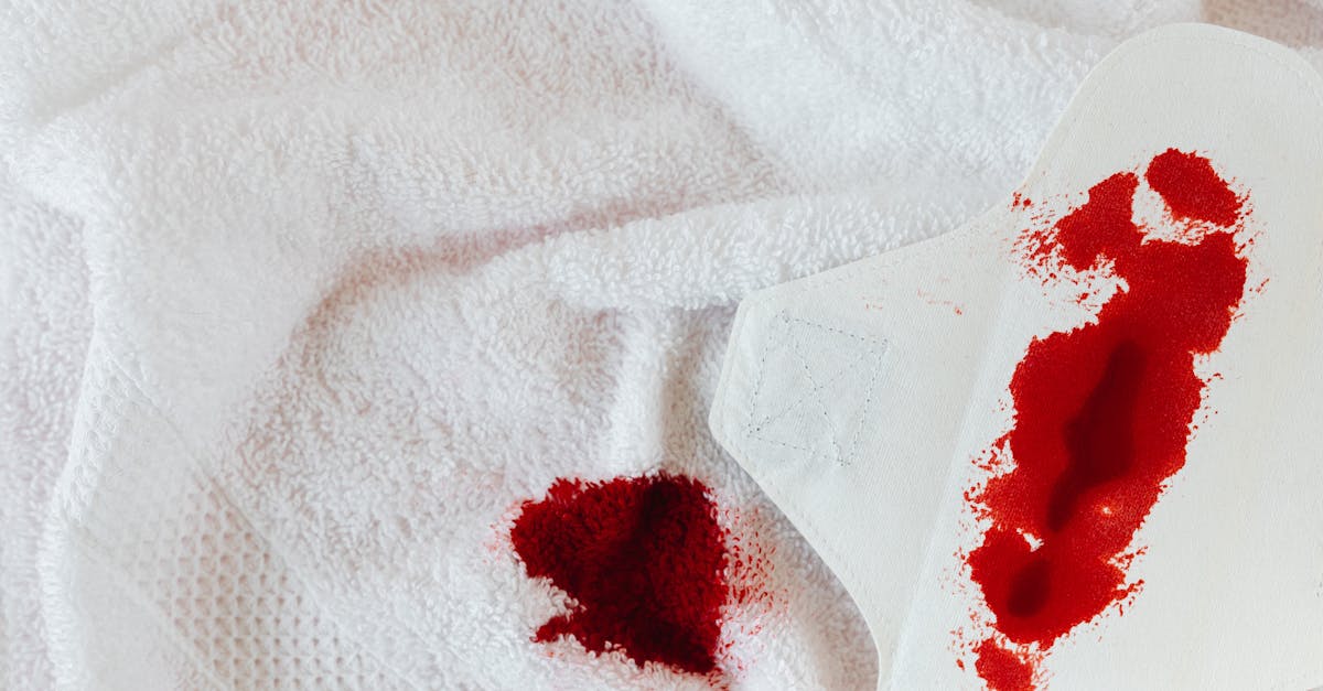 descubre cómo las migrañas menstruales afectan a muchas mujeres, sus síntomas y tratamientos efectivos para aliviarlas. aprende a identificar los desencadenantes y mejorar tu calidad de vida durante el ciclo menstrual.