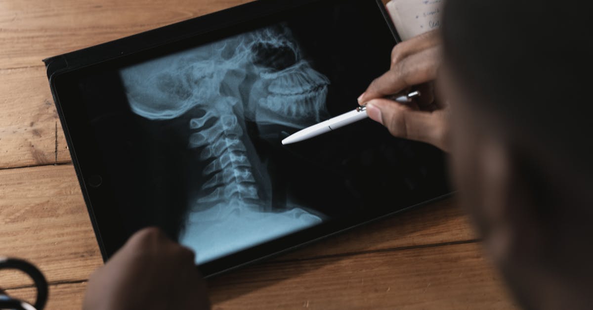 descubre todo sobre la esguince cervical: causas, síntomas y tratamientos efectivos para aliviar el dolor y recuperar la movilidad. aprende cómo prevenir lesiones y cuidar de tu salud cervical.