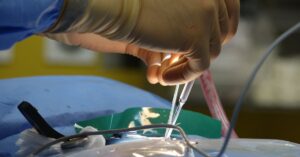 cuida de tu salud y bienestar con nuestros consejos expertos sobre el tratamiento y manejo de la hernia de disco. descubre técnicas efectivas de prevención y alivio del dolor.