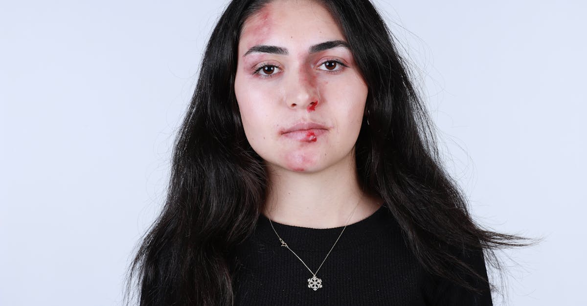 les lesiones del plexo braquial son daños que afectan a la red de nervios que controla los movimientos y la sensación en el brazo y la mano. estas lesiones pueden ocurrir durante el parto o por traumatismos, y su gravedad varía. la rehabilitación y el tratamiento adecuado son esenciales para la recuperación funcional.