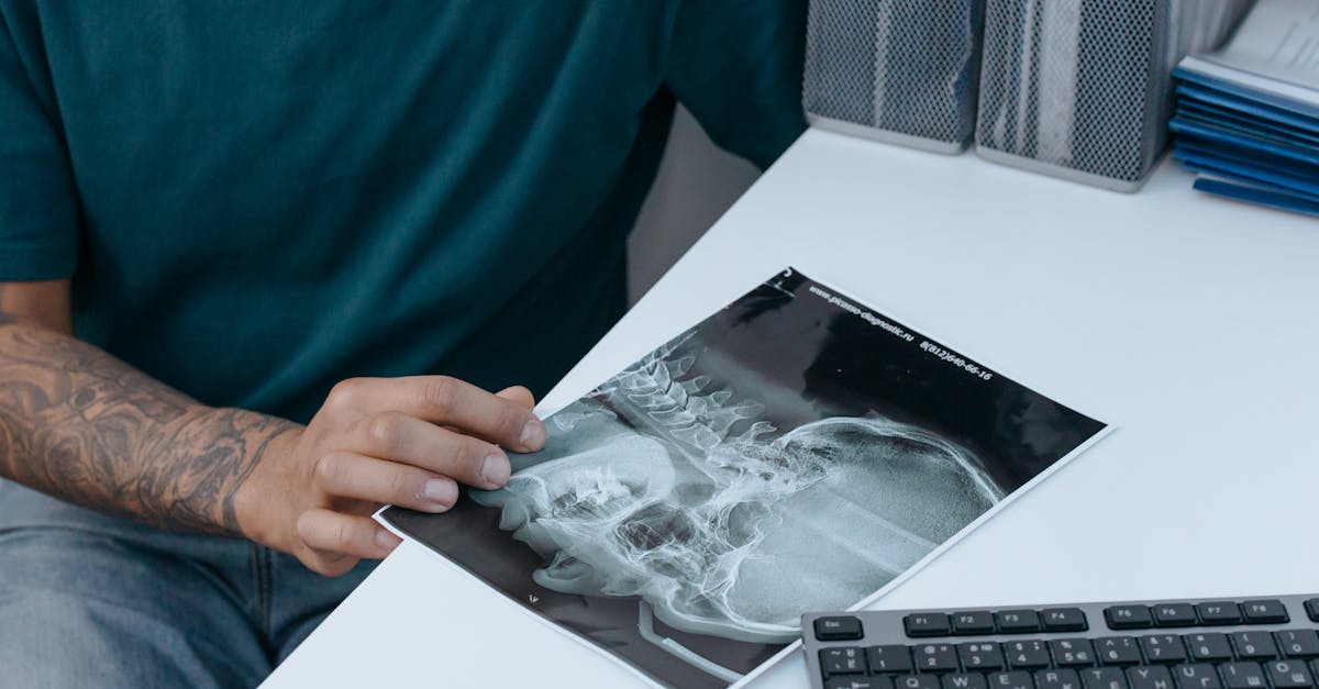 descubre qué son los espasmos cervicales, sus causas, síntomas y tratamientos efectivos para aliviar el dolor y mejorar tu calidad de vida.