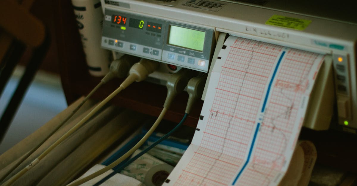 optimiza la alineación de tus pulsos con nuestra tecnología avanzada de pulse align. mejora la precisión y la eficiencia en tus procesos con soluciones personalizadas y herramientas intuitivas. descubre cómo podemos ayudarte a lograr resultados excepcionales.