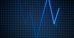 optimiza la alineación de tus equipos con pulse align, la solución perfecta para garantizar la precisión y eficiencia en tus procesos industriales.