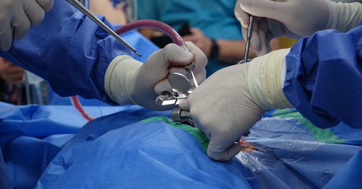 la estenosis espinal es una condición médica que causa el estrechamiento del canal espinal, lo que puede provocar dolor, debilidad y problemas de movilidad. descubre sus causas, síntomas y tratamientos para mejorar tu calidad de vida.