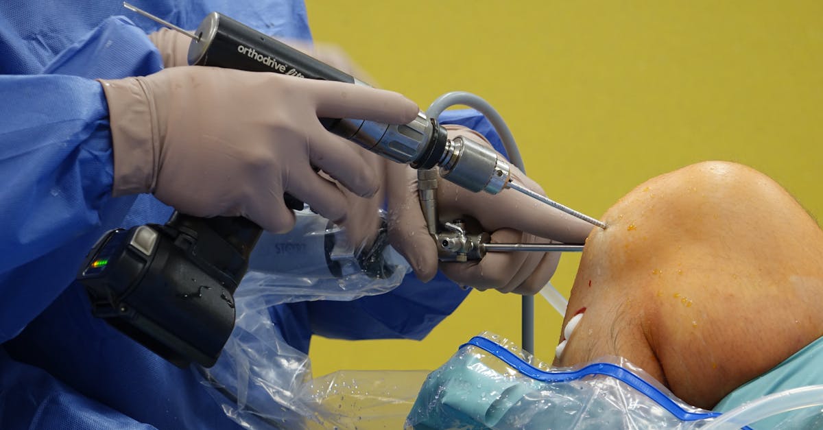 les lesiones del plexo braquial son daños en un conjunto de nervios que controlan la función del brazo y la mano. estas lesiones pueden ocurrir durante el parto, accidentes deportivos o traumatismos. encontrar información sobre causas, síntomas, diagnóstico y opciones de tratamiento es crucial para una recuperación adecuada.