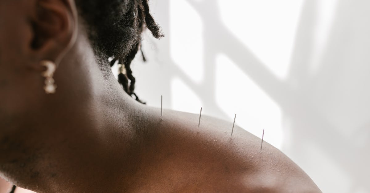 descubre las mejores soluciones para aliviar el dolor. desde tratamientos naturales hasta medicamentos efectivos, encuentra la manera de mejorar tu bienestar y disfrutar de una vida sin molestias.