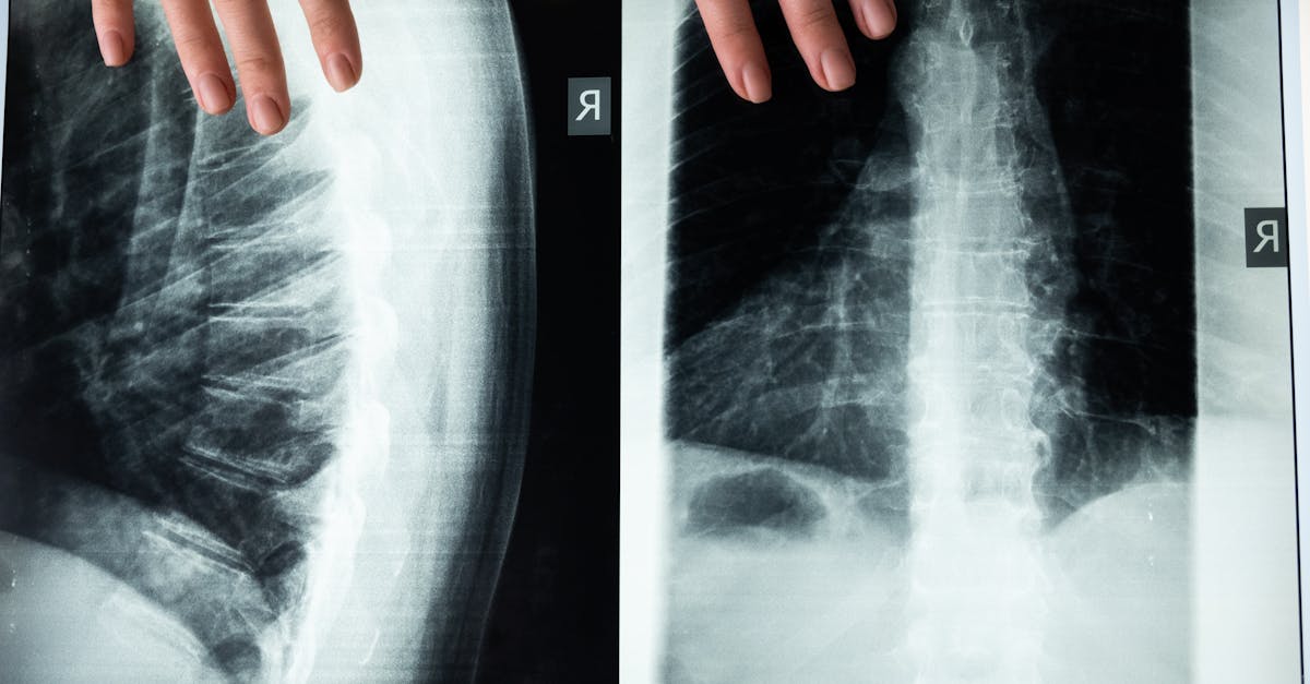 descubre la importancia de la zona lumbar para tu salud. aprende sobre ejercicios, cuidados y consejos para mantener una espalda fuerte y libre de dolores. mejora tu bienestar físico con información útil y práctica.