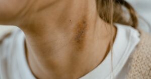 ejercicios para el dolor de cuello: descubre rutinas efectivas que aliviarán la tensión y mejorarán tu movilidad. ideal para prevenir molestias y fortalecer tu cuello.