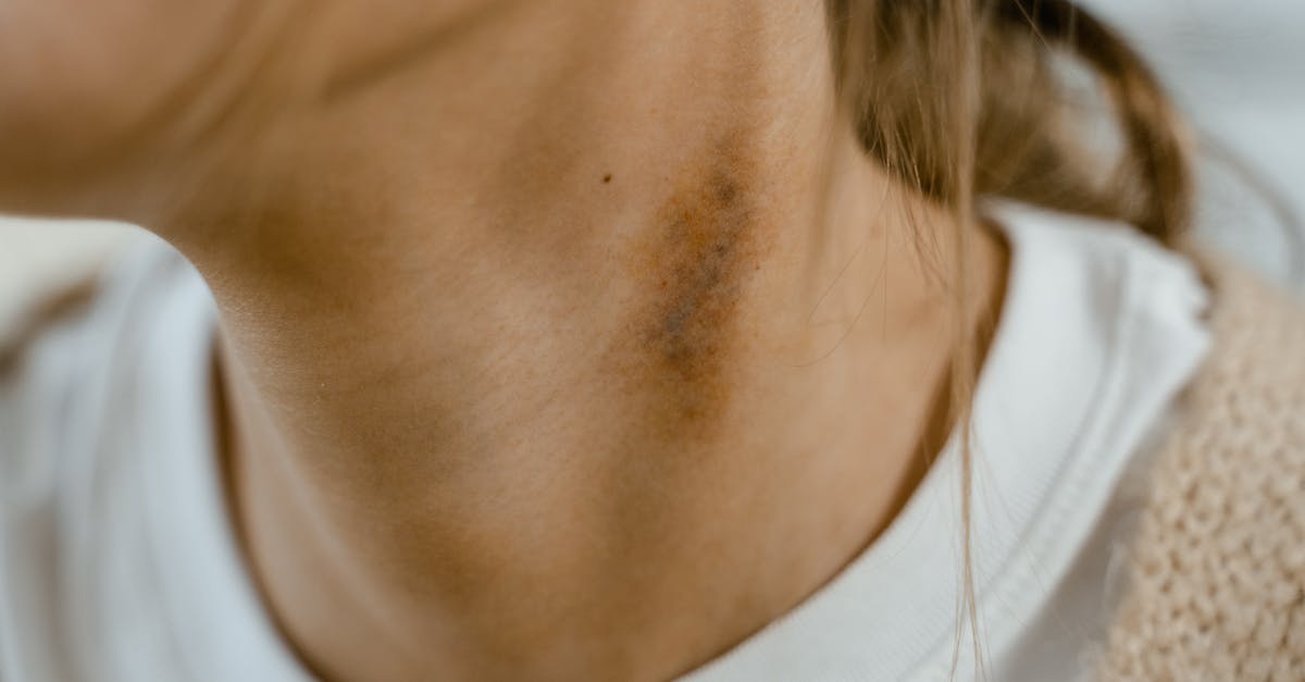 ejercicios para el dolor de cuello: descubre rutinas efectivas que aliviarán la tensión y mejorarán tu movilidad. ideal para prevenir molestias y fortalecer tu cuello.
