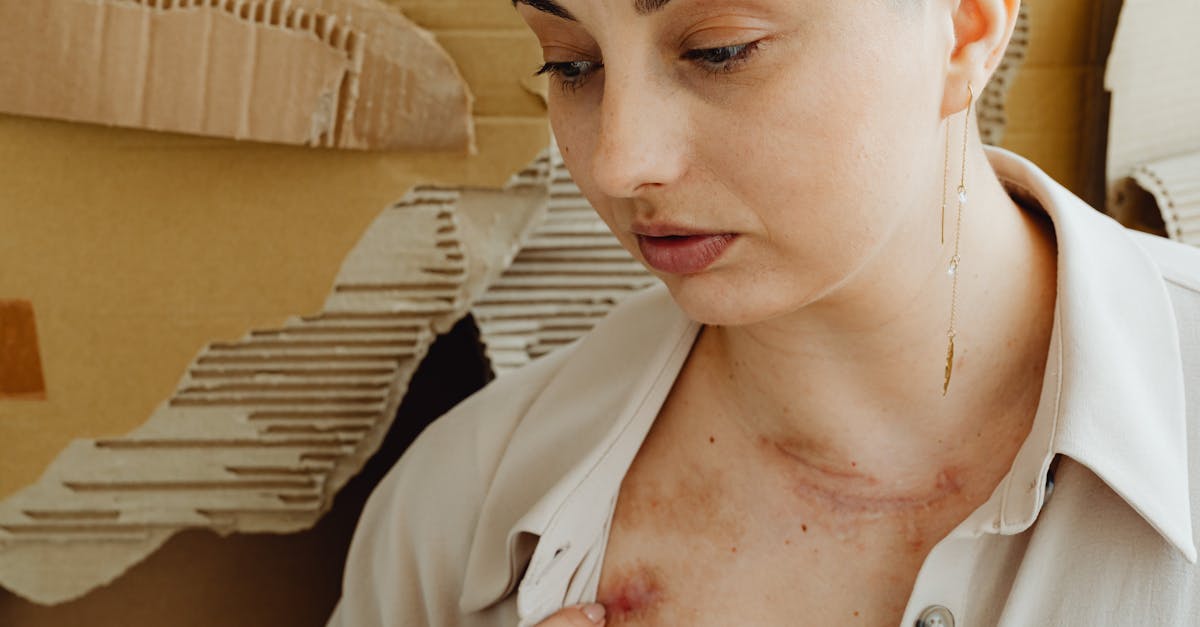 descubre las causas y tratamientos del dolor de hombro. aprende sobre los tipos de lesiones y cómo aliviar el malestar para mejorar tu calidad de vida.
