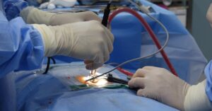 la estenosis espinal es una condición médica que provoca el estrechamiento del canal espinal, causando dolor, debilidad y problemas de movilidad. conozca los síntomas, tratamientos y estrategias para manejar esta afección eficazmente.