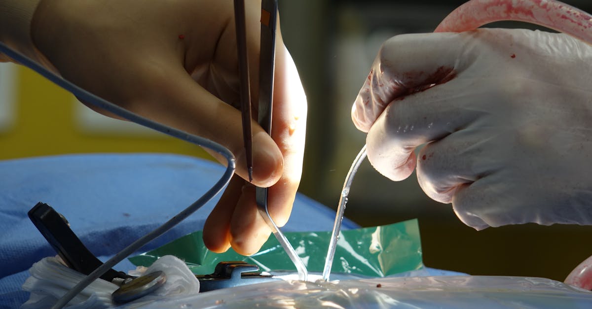 descubre qué es una hernia de disco, sus síntomas más comunes, causas principales y opciones de tratamiento para aliviar el dolor y mejorar tu calidad de vida.