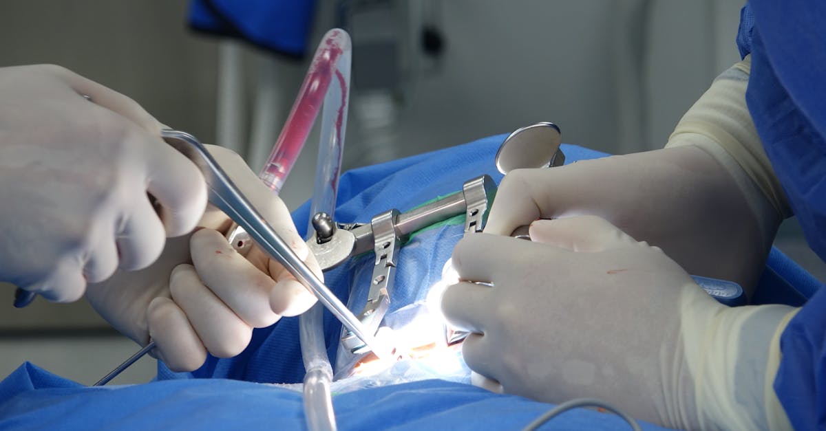 descubre qué es una hernia discal, sus causas, síntomas y tratamientos efectivos. encuentra información útil para aliviar el dolor de espalda y mejorar tu calidad de vida.