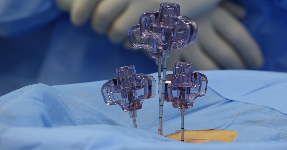 descubre todo sobre la hernia de disco: síntomas, causas, tratamientos y consejos para prevenir este problema de salud que afecta a la columna vertebral. encuentra información útil y actualizada.