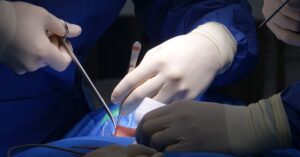 descubre todo sobre la hernia discal: causas, síntomas, tratamientos y consejos para el manejo eficaz del dolor de espalda. información clara y actualizada para tu bienestar.